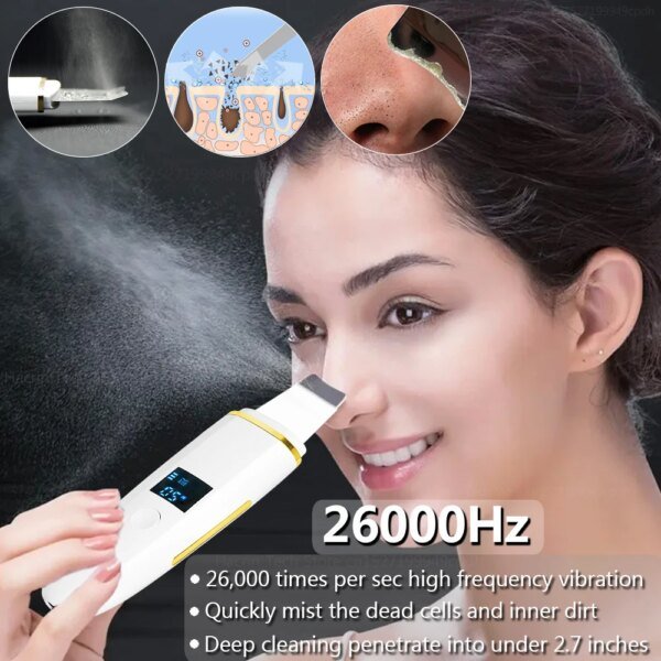 Limpiador ultrasónico de piel, removedor de puntos negros, exfoliante ultrasónico, pala facial, lifting facial, elimina poros, acné, limpieza profunda - Image 3