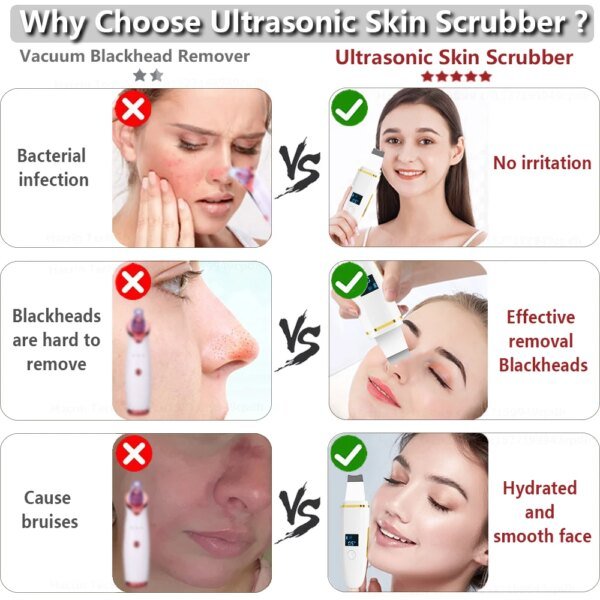 Limpiador ultrasónico de piel, removedor de puntos negros, exfoliante ultrasónico, pala facial, lifting facial, elimina poros, acné, limpieza profunda - Image 6