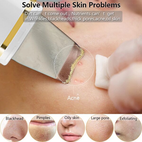 Limpiador ultrasónico de piel, removedor de puntos negros, exfoliante ultrasónico, pala facial, lifting facial, elimina poros, acné, limpieza profunda - Image 2