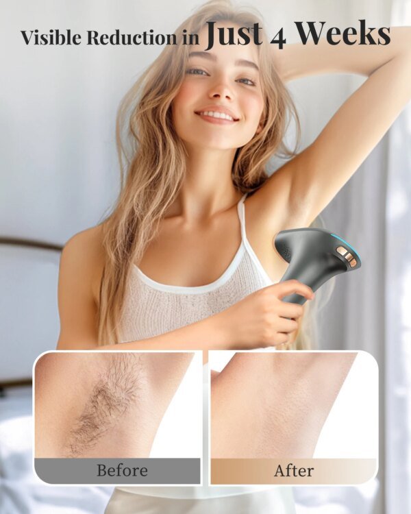 Depiladora láser profesional IPL, depiladora permanente indolora con HR/SC/RA, 9 niveles de energía, recortadora de vello corporal ligera - Image 6