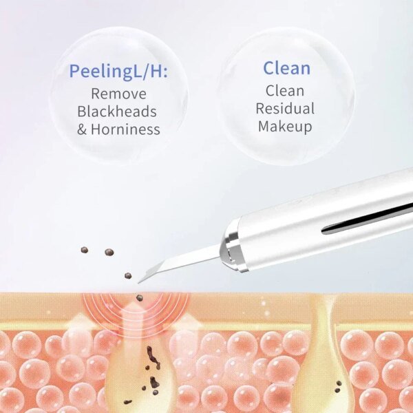 Depurador eléctrico de piel, removedor de puntos negros, limpieza facial profunda, lifting, limpiador de poros iónico para acné, espátula facial, pala limpiadora - Image 3