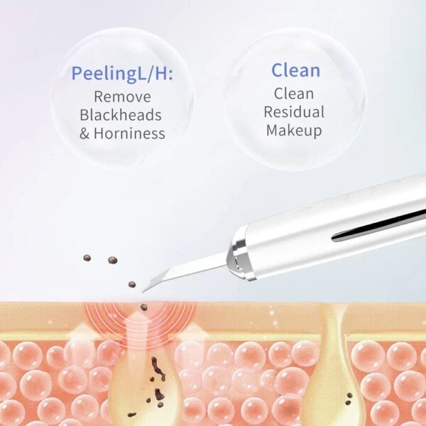 Depurador eléctrico de piel, removedor de puntos negros, limpieza facial profunda, lifting, limpiador de poros iónico para acné, espátula facial, pala limpiadora - Image 4
